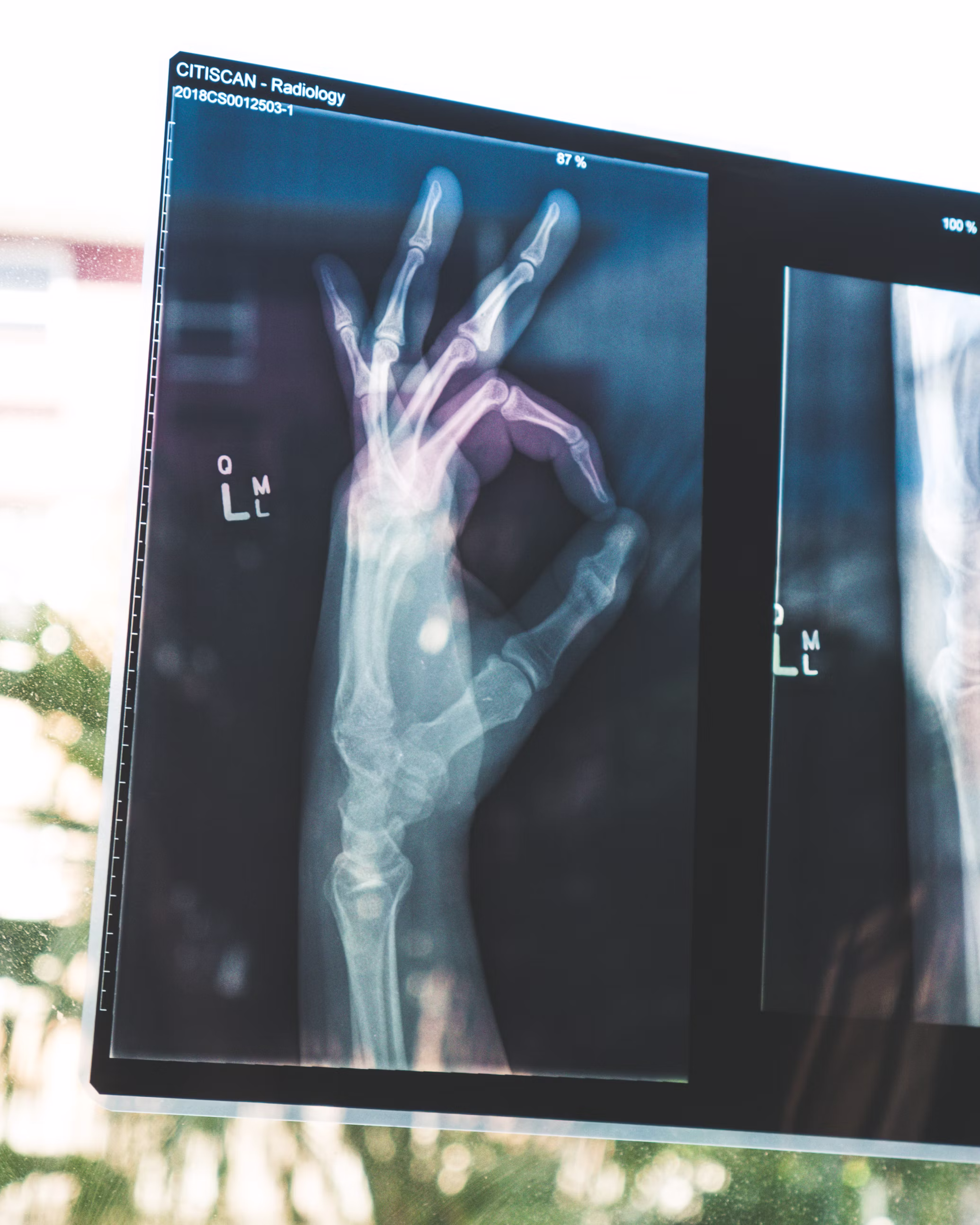 AI-Assisted Diagnostics