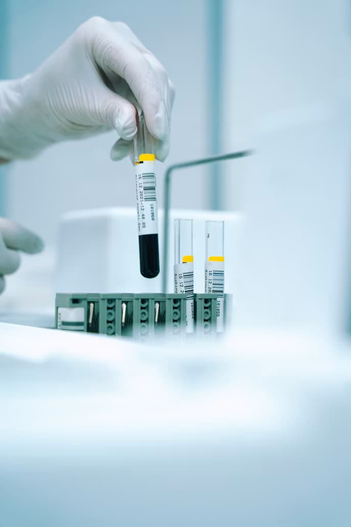 Clinical Trials